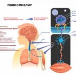 Профилактика полиомиелита